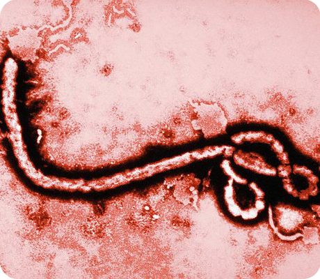 вирус эбола
