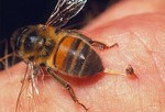 Чем дольше не вынимать жало пчелы, тем больше яда попадет в кровь.
Пчелы.
В основном реакция на укусы пчел средней серьезности: небольшая опухоль, боль и зуд. У некоторых людей встречаются более серьезные реакции на укус: крапивница, опухоль полости рта или горла, затрудненное дыхание. Если у вас серьезная анафилактическая реакция, нужно как можно быстрее удалить жало. Используйте эпинефрин, если есть. Завяжите жгут выше укуса, чтобы не дать яду распространяться дальше и немедленно окажите медицинскую помощь. Если аллергической реакции не наблюдается, извлеките жало, очистите место укуса, примите антигистамин, чтобы уменьшить зуд.