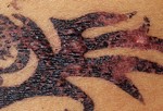 Волдыри в области временной татуировки хной.
Реакция кожи на татуировки хной.
Управление по контролю за продуктами и лекарствами получило множество жалоб на раздражения кожи и аллергические реакции на временные татуировки хной, особенно так называемой «черной хной». Черная хна содержит анилиновый краситель п-фенилендиамина, который вызывает у некоторых людей аллергическую реакцию. Хну получают из растений, поэтому натуральная хна коричневых или красно-коричневых оттенков. А для получения других оттенков или усиления стойкости и насыщенности цвета в хну добавляют другие ингредиенты.