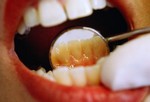 Откройте рот и скажите «А-а»!
Регулярно посещайте стоматолога. Абразивные и полирующие методы, используемые стоматологами, позволяют удалить все пятна на зубах, причиной которых являются пища и табак.