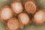 Чем отличается текущая вспышка свиного гриппа?
Вспышка свиного гриппа спровоцирована новым видом вируса свиного гриппа, который распространяется от человека к человеку, и поражает людей, которые никогда не имели контакта со свиньями. Увеличенная фотография вируса свиного гриппа.