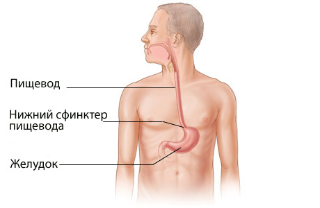 гастроэзофагеальная рефлюксная болезнь 