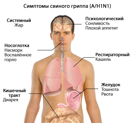 Свиной грипп A/H1N1