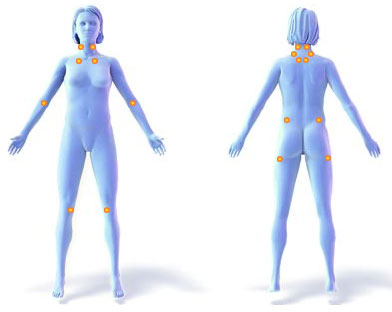 Болевые точки при фибромиалгии